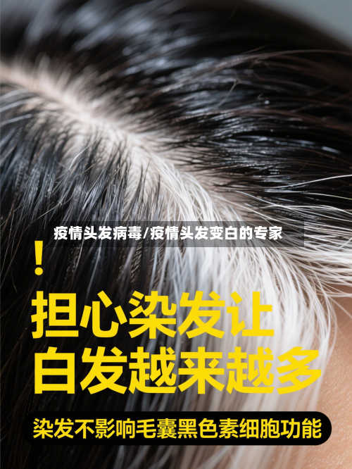 疫情头发病毒/疫情头发变白的专家-第2张图片